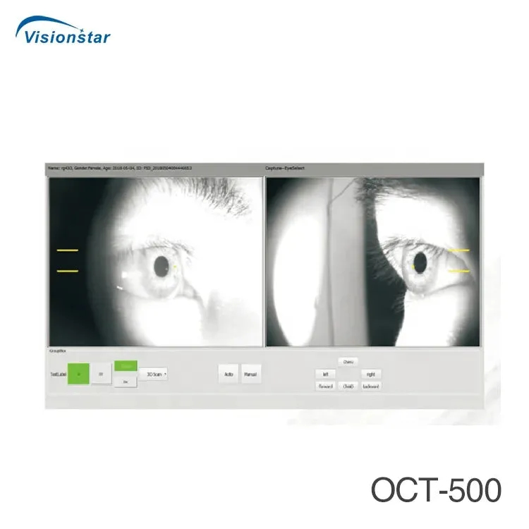 Optical Coherence Tomography Ophthalmology OCT Machine for Eye Exam I Model MRetiview500