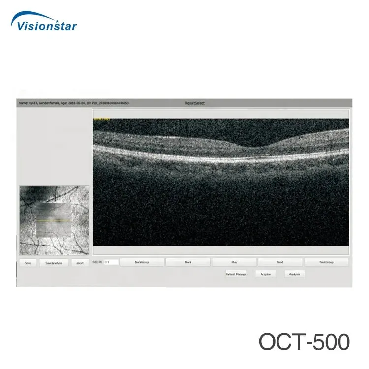 Optical Coherence Tomography Ophthalmology OCT Machine for Eye Exam I Model MRetiview500