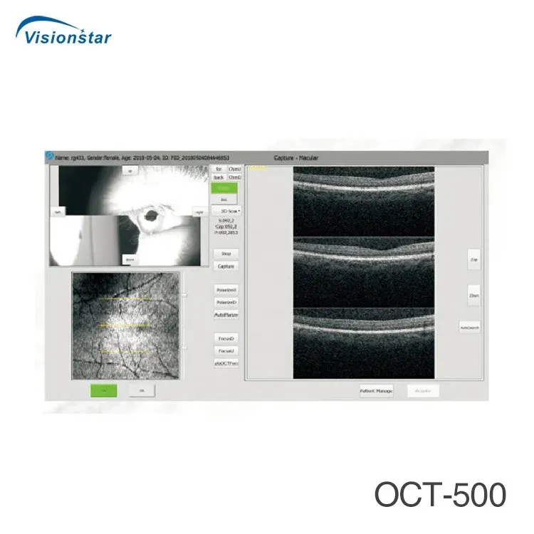 Optical Coherence Tomography Ophthalmology OCT Machine for Eye Exam I Model MRetiview500